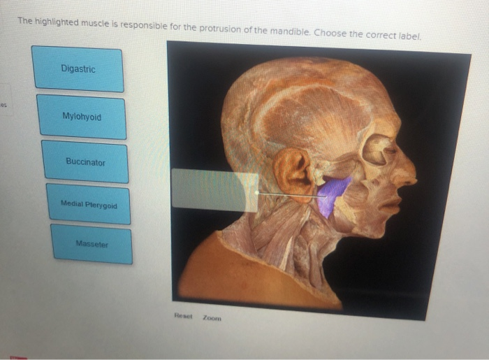 solved-the-highlighted-muscle-is-responsible-for-the-chegg