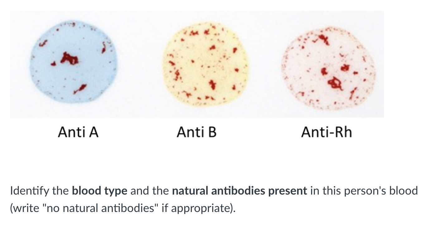 Solved Identify the blood type and the natural antibodies