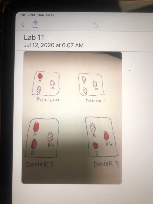 Solved BIOL 2114 Human Physiology Blood Typing Lab | Chegg.com