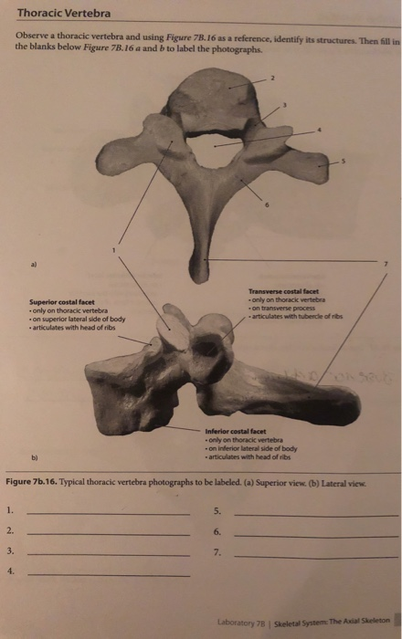 Thoracic Vertebra Observe A Thoracic Vertebra And Chegg Com
