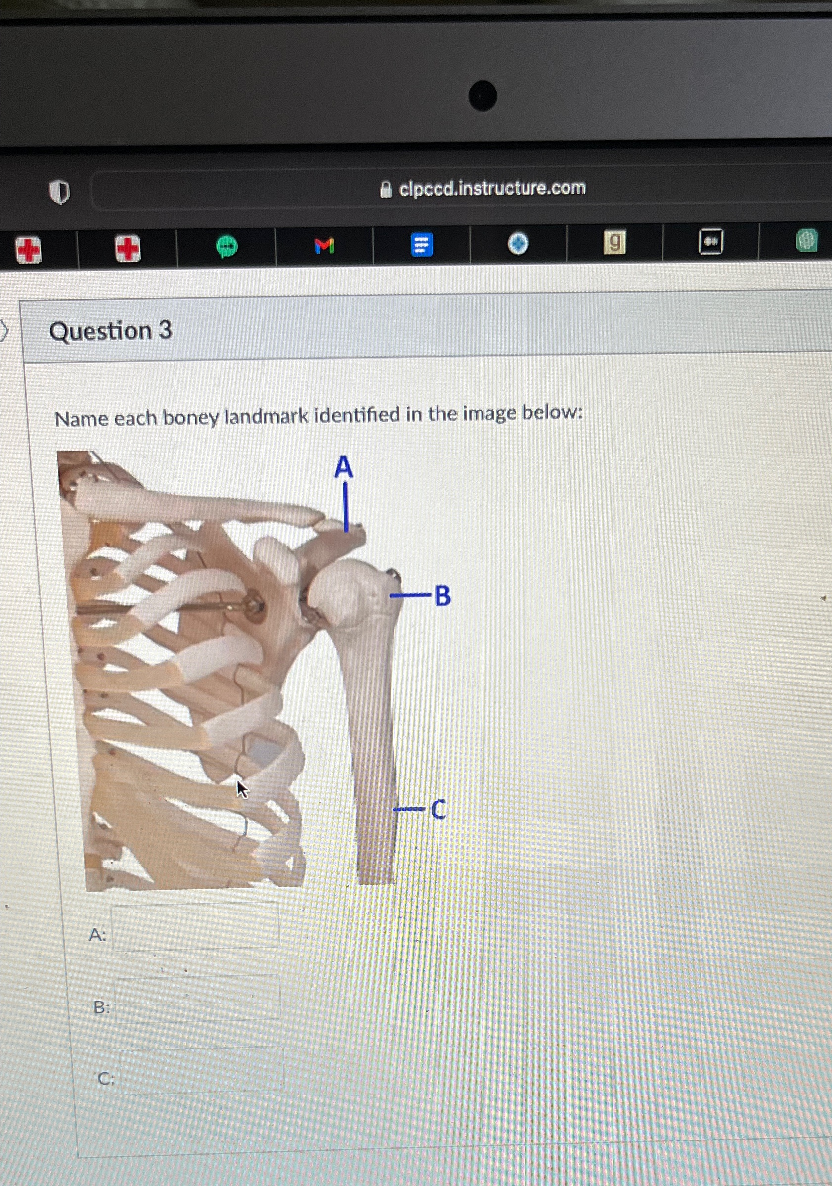 Solved Question 3Name each boney landmark identified in the | Chegg.com