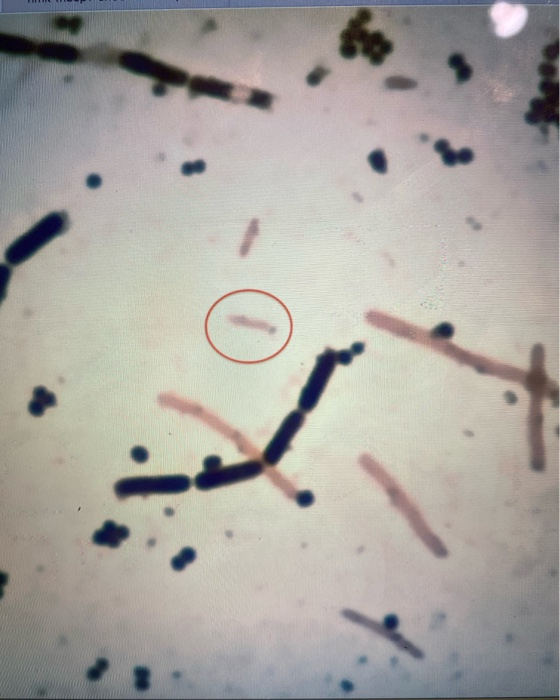 Solved Use the micrograph of the Gram stain to draw | Chegg.com