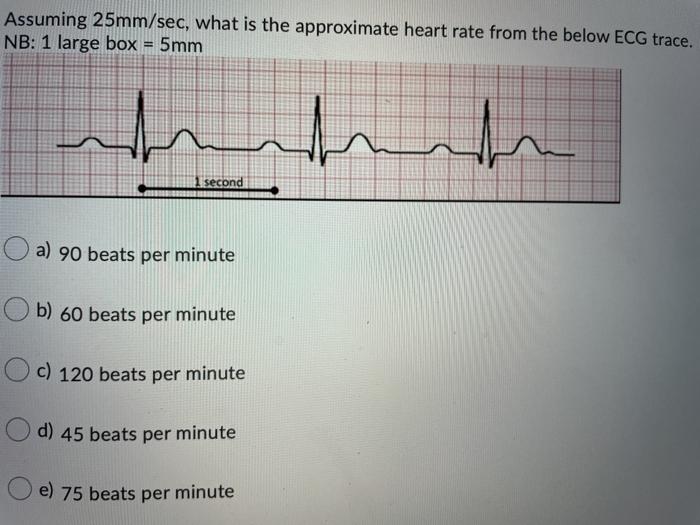 Assuming 25mm/sec, is the heart rate | Chegg.com