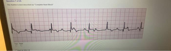 Solved This rhythm in the image is best described as | Chegg.com