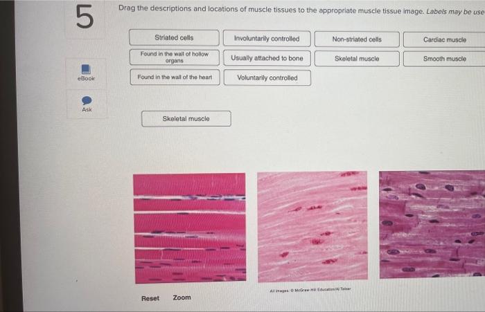 Solved What type of epithelial membrane lines body cavities | Chegg.com