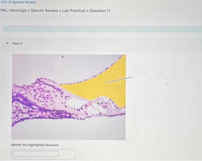 Solved Special Senses > Lab Practical > Question 11 Part A | Chegg.com