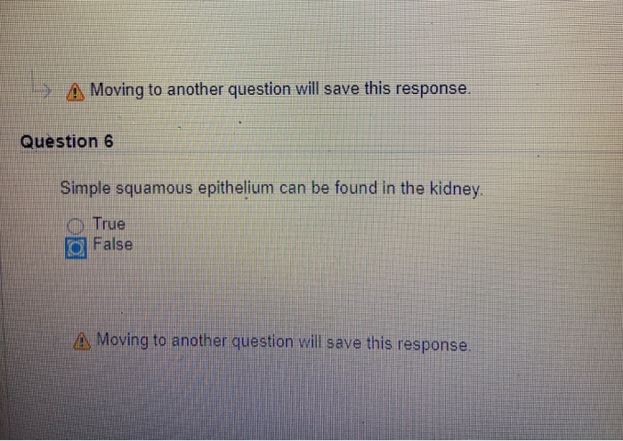 Solved Di A Moving To Another Question Will Save This Chegg Com Solved Di A Moving To Another Question, What Is Basement Membrane Made Up Of