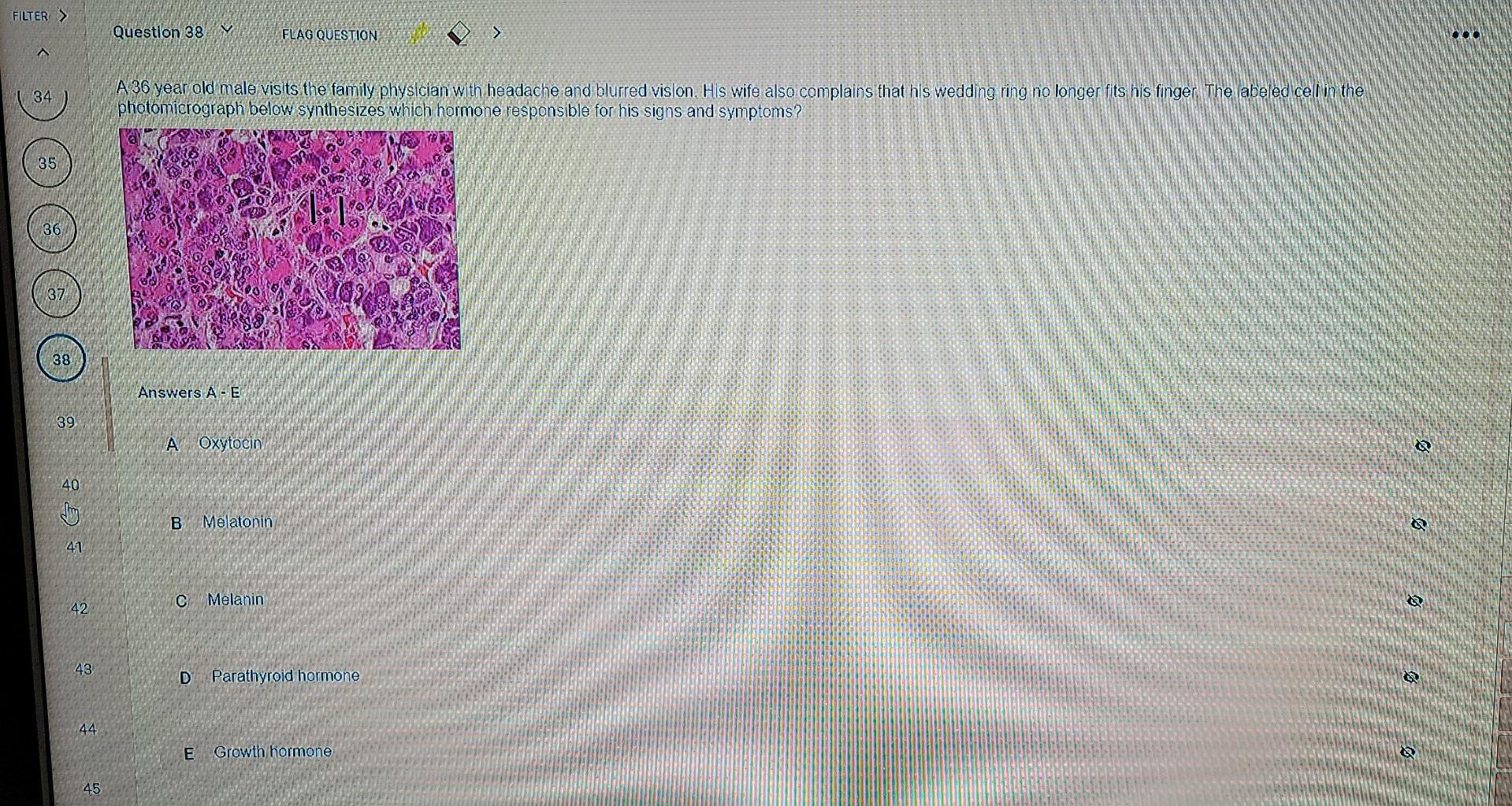 Solved FILTER > Question 38 FLAG QUESTION > A 34 A 36 year | Chegg.com