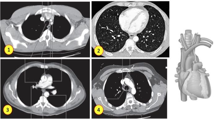 Solved Examine these Contrast enhanced CT images of the | Chegg.com