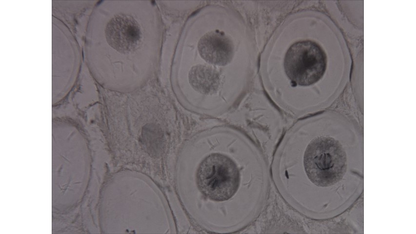 With The Following Photo (whitefish Blastula):1. 