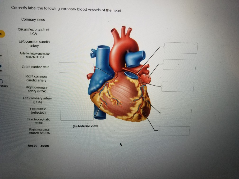 Solved Correctly label the following coronary blood vessels | Chegg.com