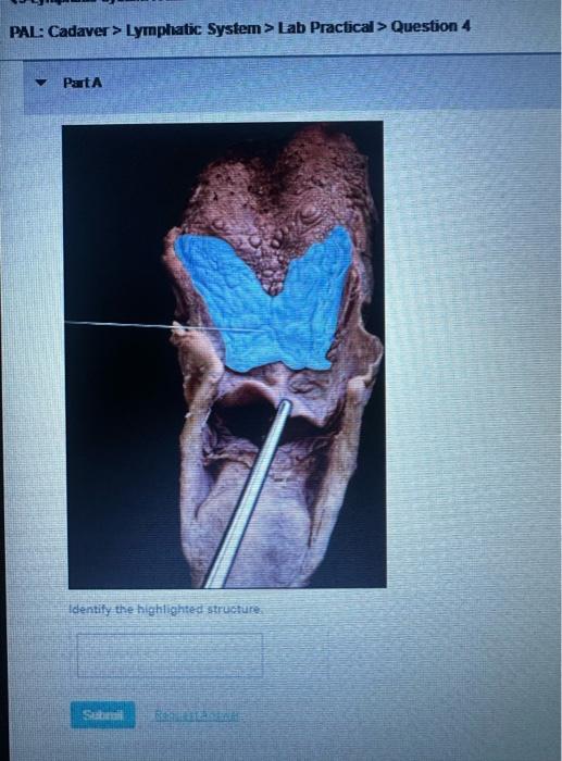 PAL: Cadaver \( > \) Lymphatic System \( > \) Lab Practical \( > \) Question 4
PartA
identily the highlighted struature.