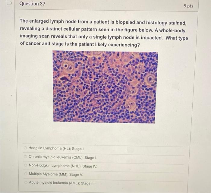 Solved Question 37 5 pts The enlarged lymph node from a | Chegg.com