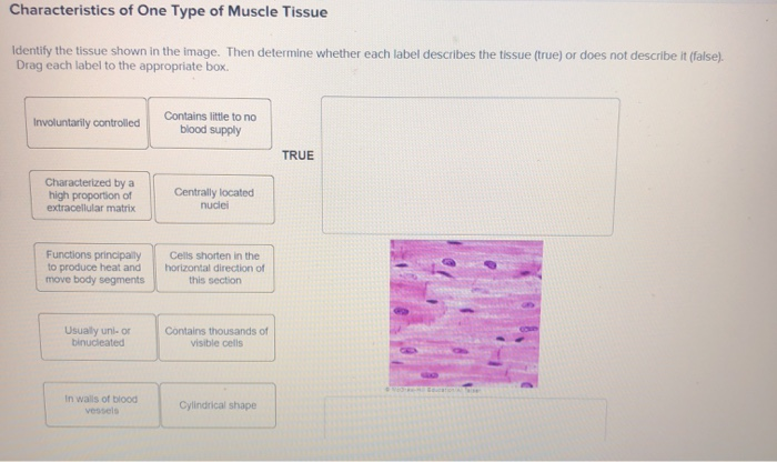 Solved Characteristics of One Type of Muscle Tissue Identify | Chegg.com