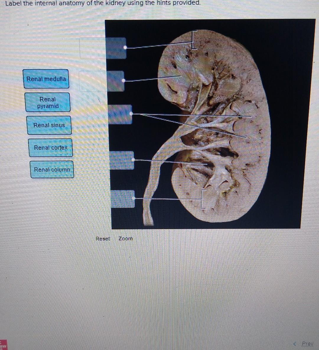 Solved Label the CT scan of the abdominal contents using the | Chegg.com