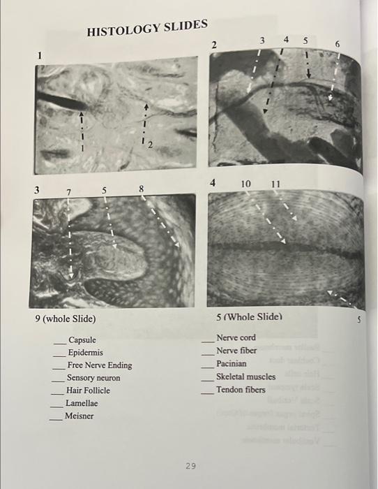 free nerve endings histology