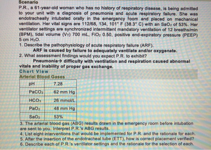 solved-scenario-p-r-a-61-year-old-woman-who-has-no-history-chegg