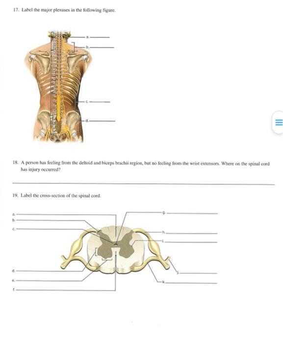 Solved 17 Label The Major Plexuses In The Following Figure 8966