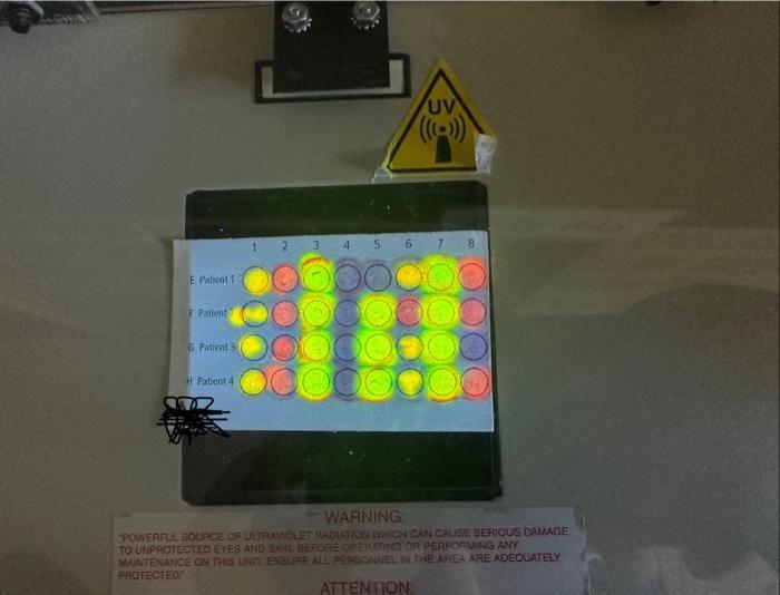 Solved AMMAE SHUTCOED DNA/RNA Microarray PostLab Questions
