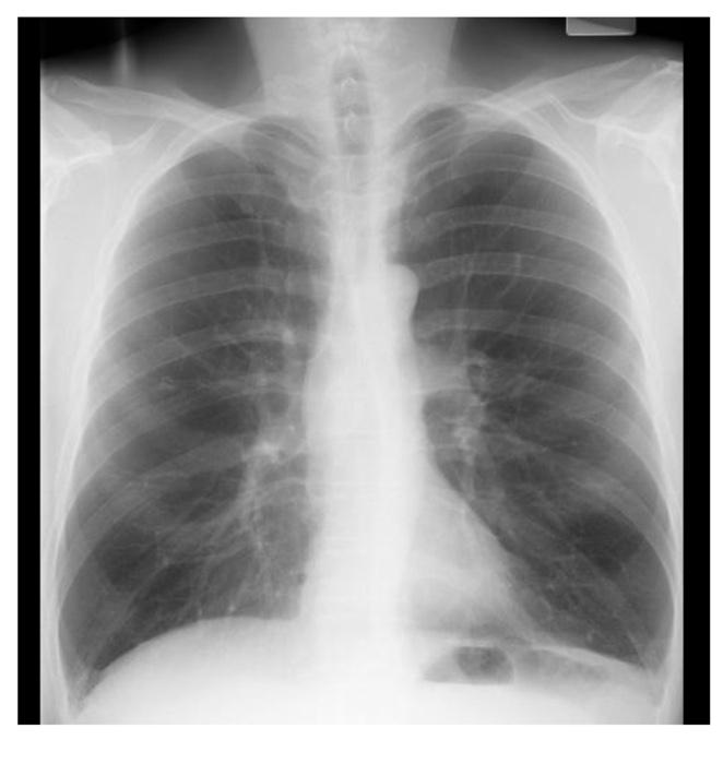 Solved Chapter 03: Lung Volumes and Gas Distribution Tests | Chegg.com