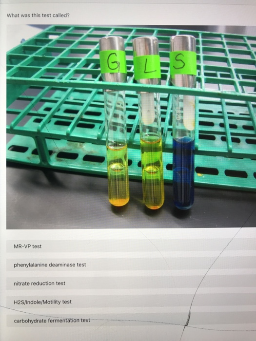 Solved What Was This Test Called? Mr-vp Test Phenylalanine 