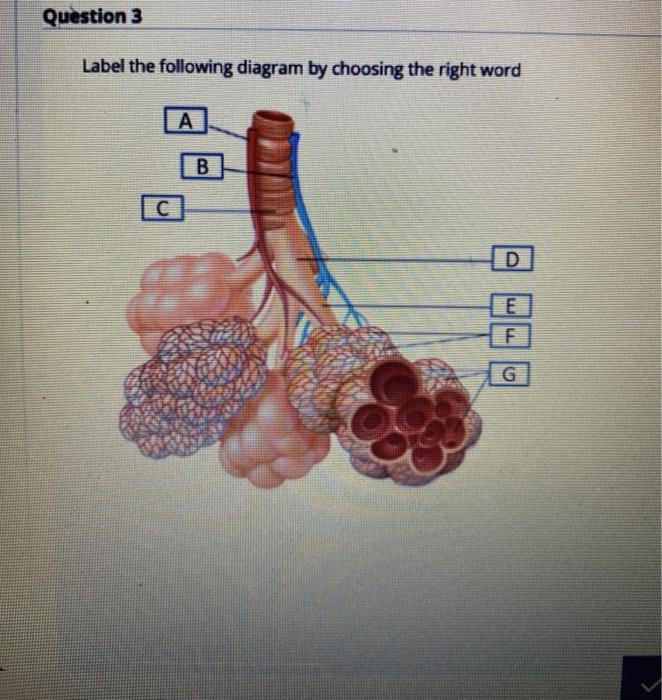 Solved Question 3 Label the following diagram by choosing | Chegg.com