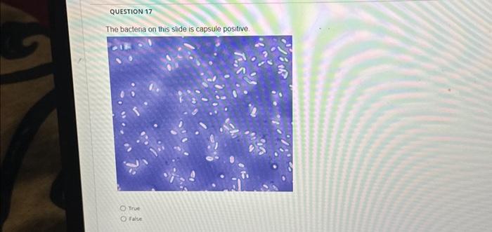 Solved The bactena on this stide is capsule positive. True | Chegg.com