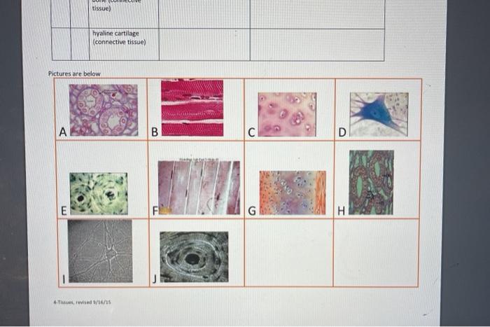 Solved Lab 4- Tissue Types There are two pictures for each | Chegg.com