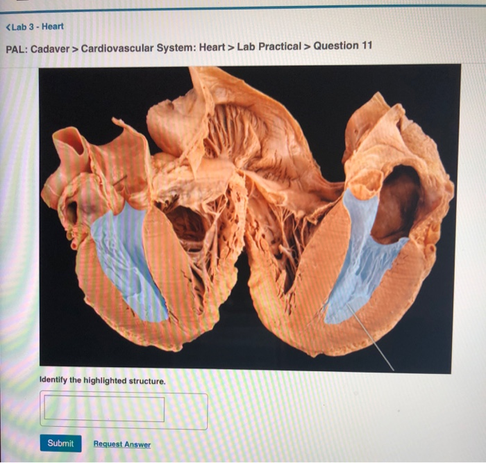 solved-cardiovascular-system-heart-lab-practical-chegg