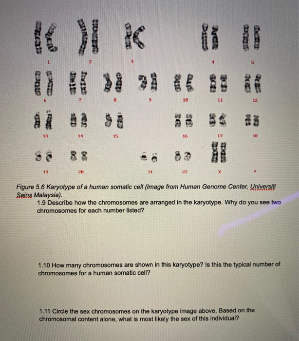 Solved Chromosomal Disorders can be Diagnosed with Karyotype | Chegg.com