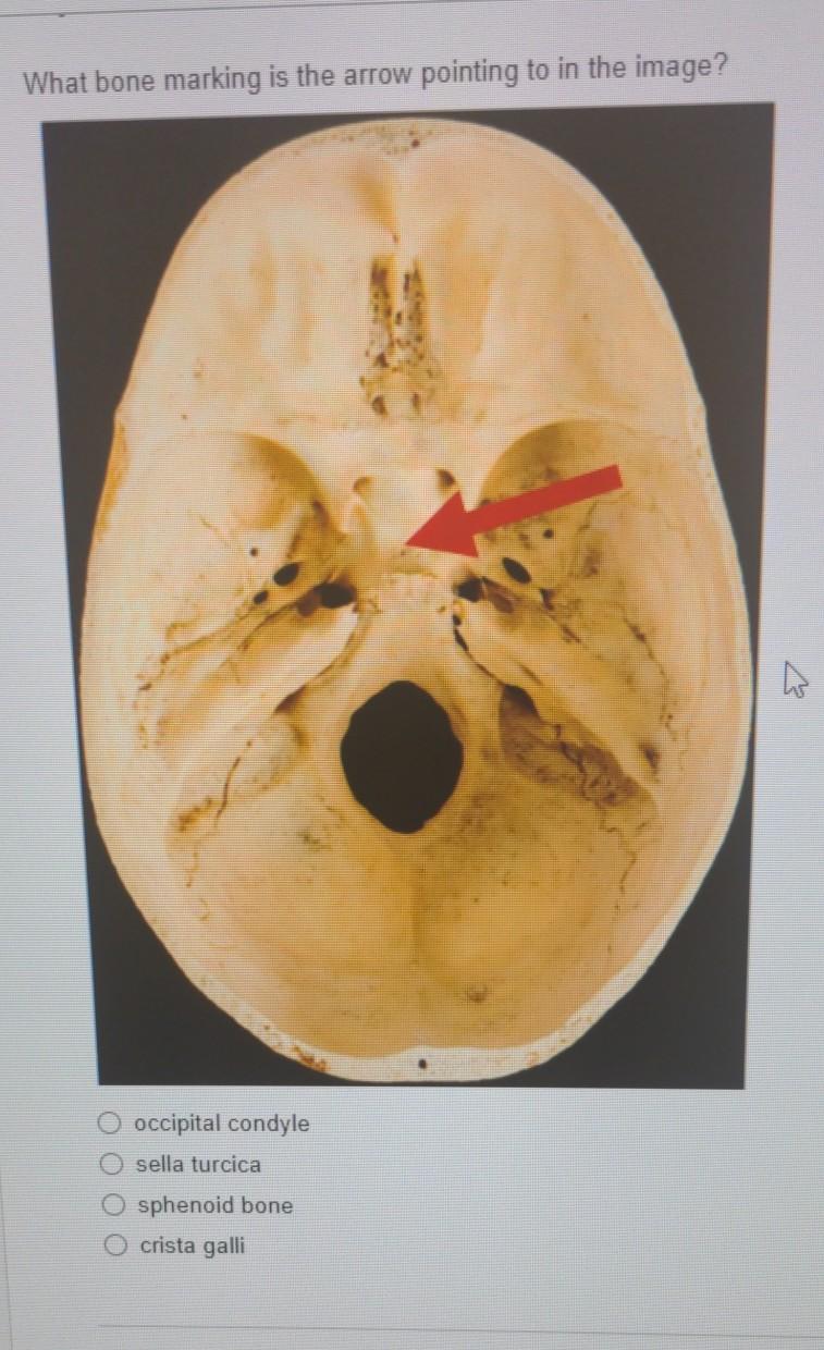 Solved What bone marking is the arrow pointing to in the | Chegg.com