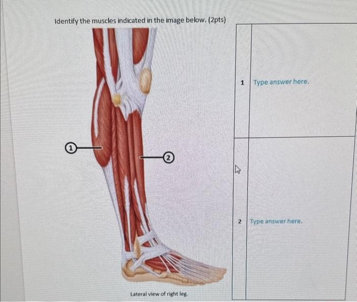 Solved Identify the muscles indicated in the image below. | Chegg.com