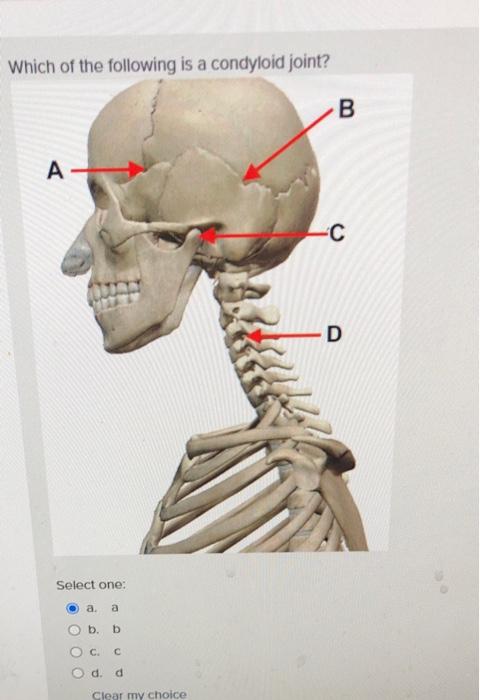 Solved Which of the following is a condyloid joint? B А -С D | Chegg.com