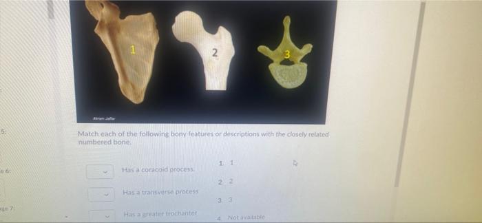 Listen The muscle indicated by the arrow is named | Chegg.com