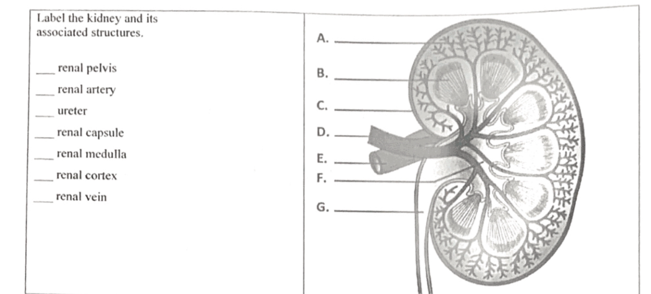 Solved Label the kideny and its associated structures- | Chegg.com