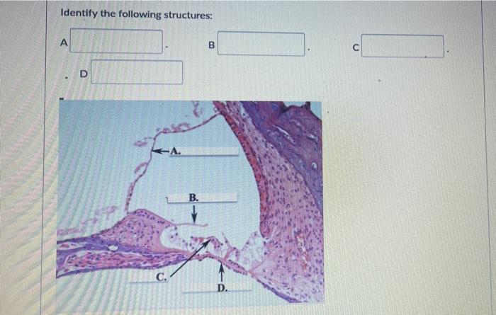 Solved Identify the following structures: A B C A. B. C. D. | Chegg.com