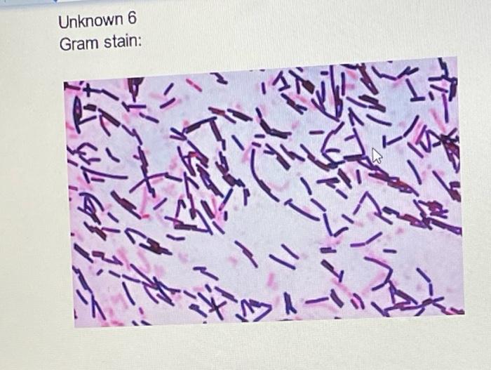 Solved Unknown 6 Gram stain:Assignment 4: Identity of Your | Chegg.com
