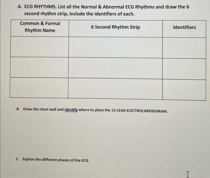 Solved A. ECG RHYTHMS. List all the Normal \& Abnormal ECG | Chegg.com