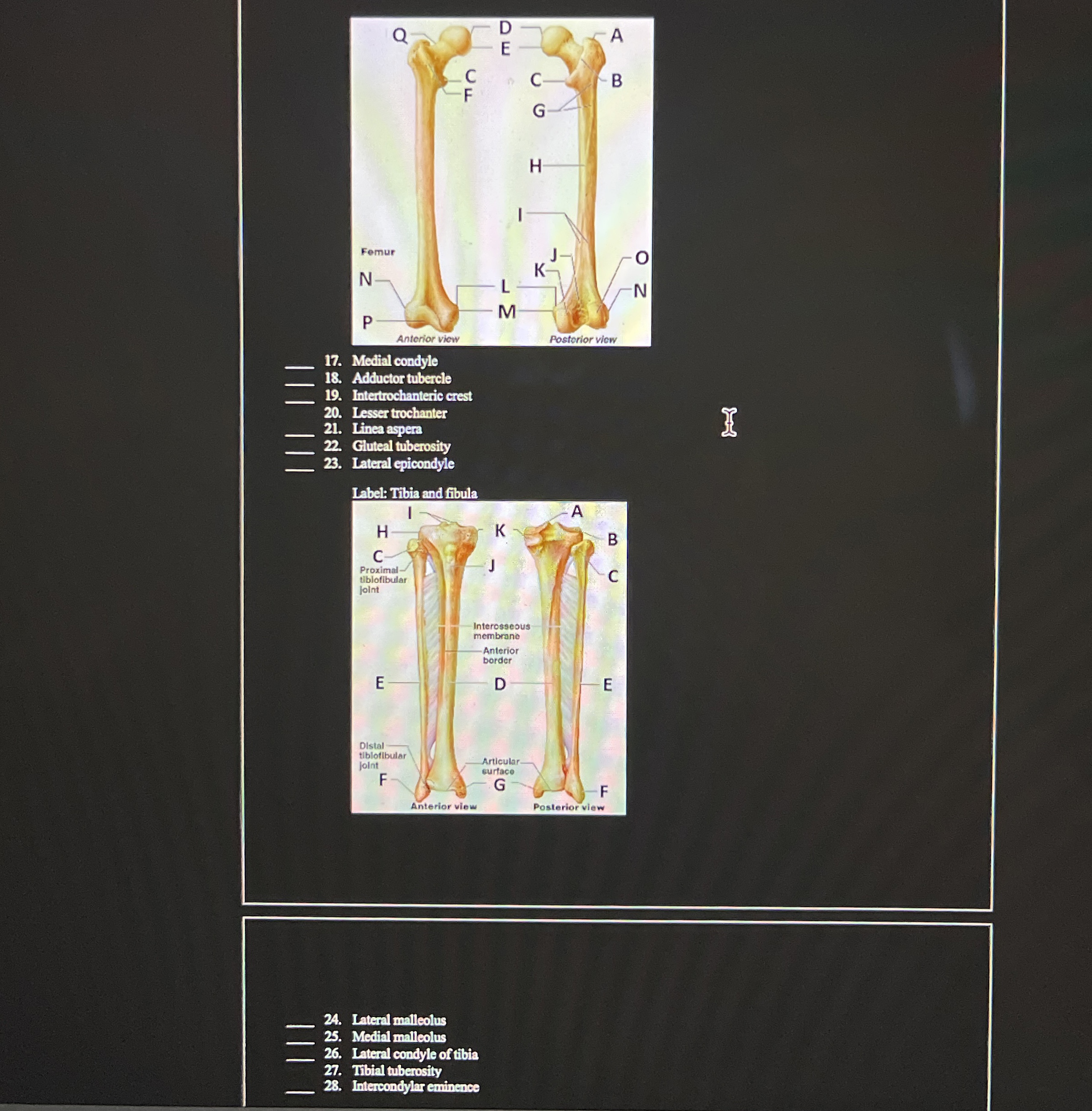 [Solved]: Mermiconcyse Adductor tubercle Intertochanteric cr