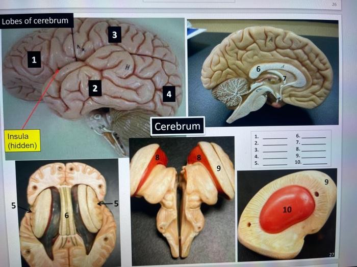 Solved 26 Lobes of cerebrum 3 1 N 4 Cerebrum Insula (hidden) | Chegg.com