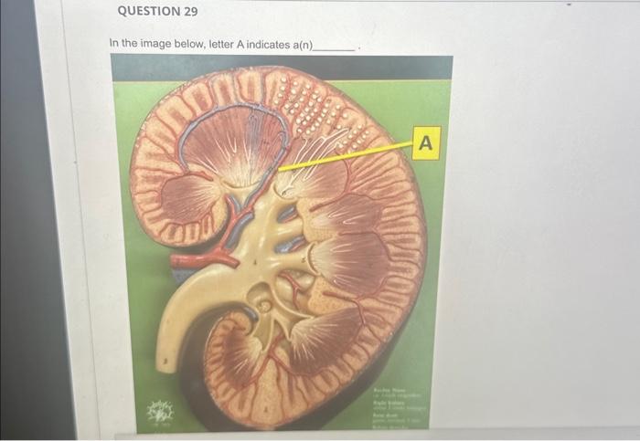 In the image below, letter A indicates a( n) | Chegg.com