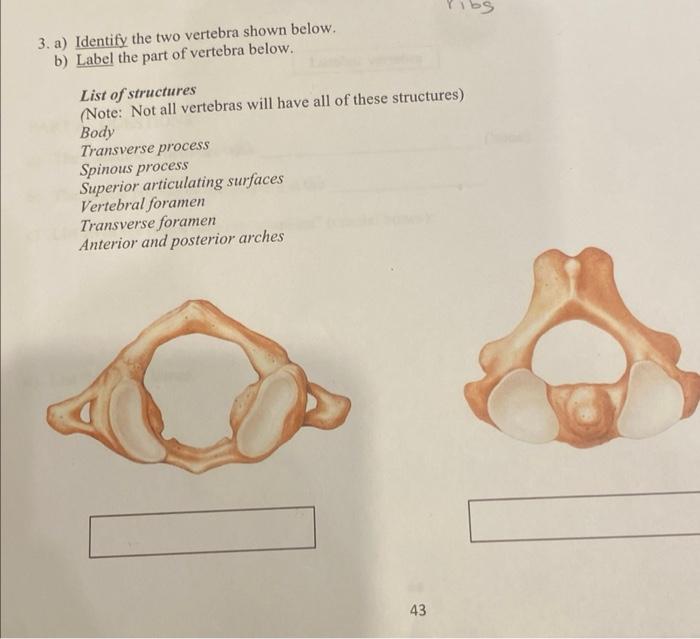 Solved 3. a) Identify the two vertebra shown below. b) Label | Chegg.com