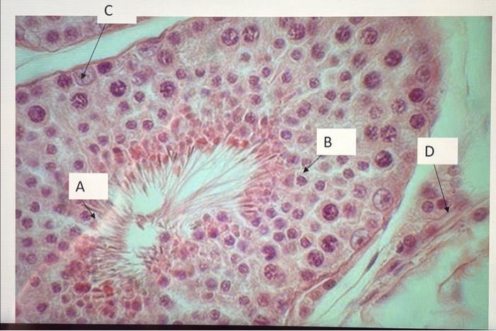 Solved The cells labeled with the letter B will replicate | Chegg.com