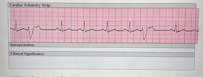 Cardiac Telemetry Strip: : سالہام۔ Interpretation: Clinical Significance: