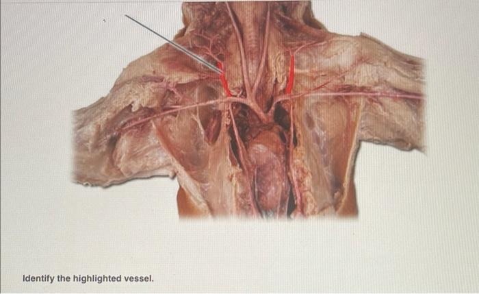 Identify the highlighted vessel.