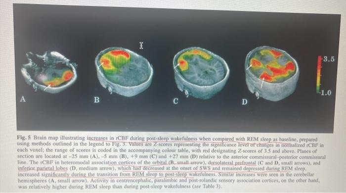 Fig. 5 Brain map illustrating increases in rCBF | Chegg.com