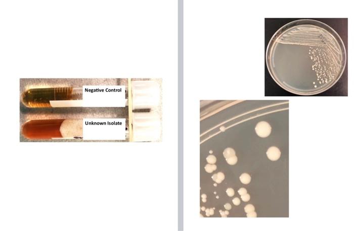 Solved Identification Scheme for Selected Gram Negative | Chegg.com
