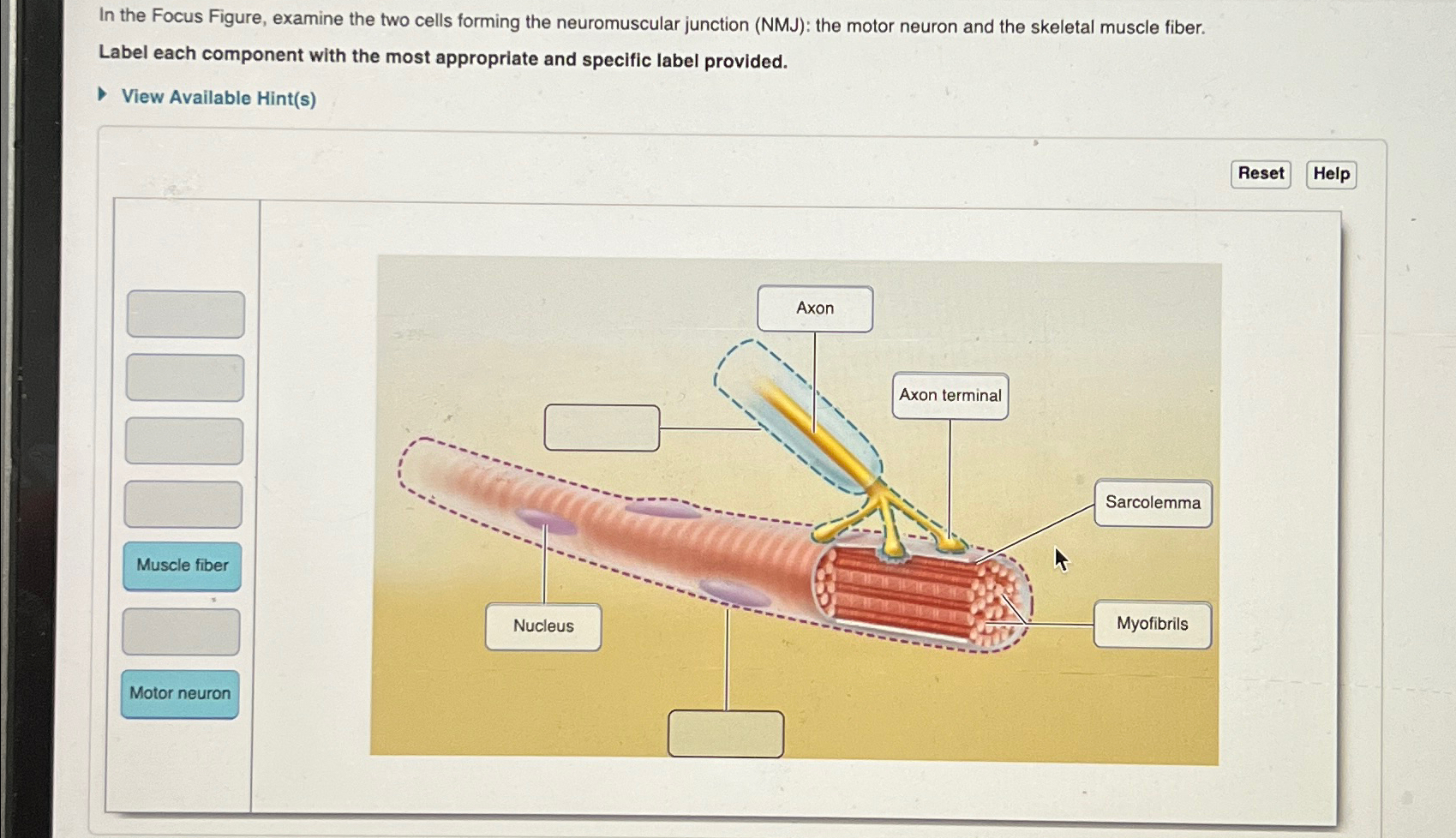 Solved In the Focus Figure, examine the two cells forming | Chegg.com