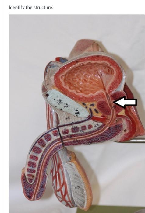 Solved Identify the structure. BE 43 23 33 | Chegg.com