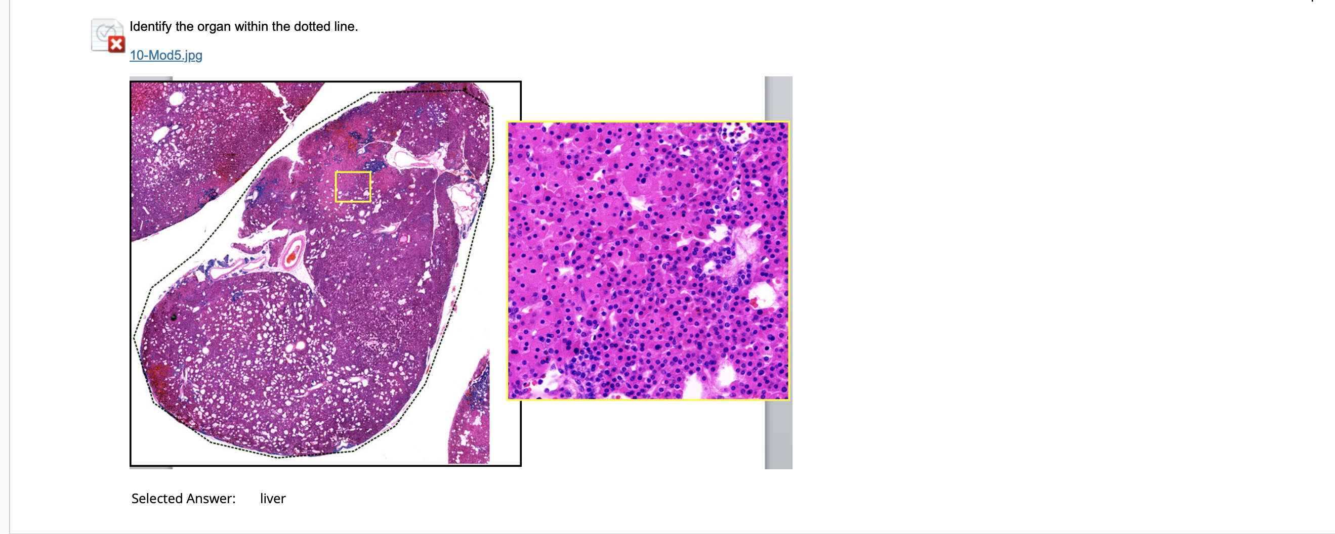 Solved Identify the organ within the dotted line. | Chegg.com